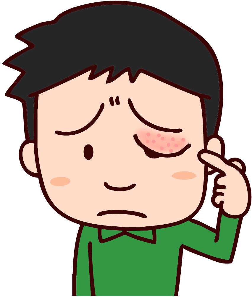 トリビア ン台湾 Vol 56 ものもらいになると言われる迷信 台北ジャピオンウェブサイト 台北情報 台北ジャピオンwebサイト